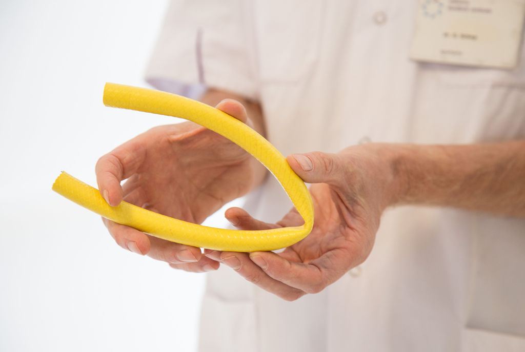 "Vergelijk het met een tuinslag die je steeds op hetzelfde punt buigt."